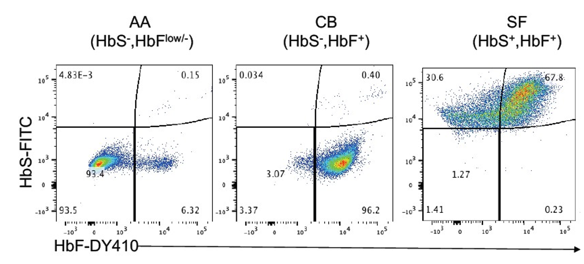 Hemoglobin S and hemoglobin F flow cytometry sickle cell